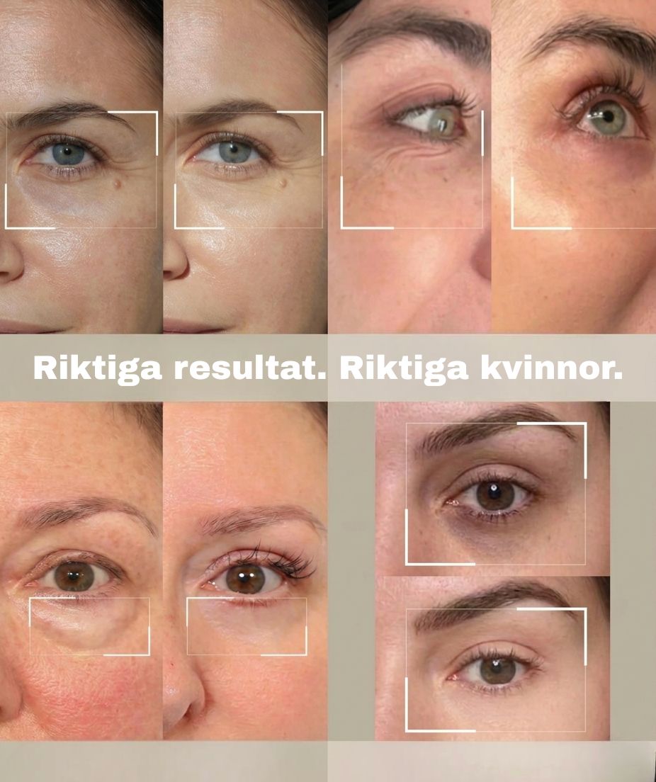 Gaze Aura - Microneedle ögonmask
