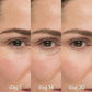 Gaze Aura - Microneedle ögonmask